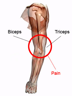 The biceps and triceps muscles are found in Fore